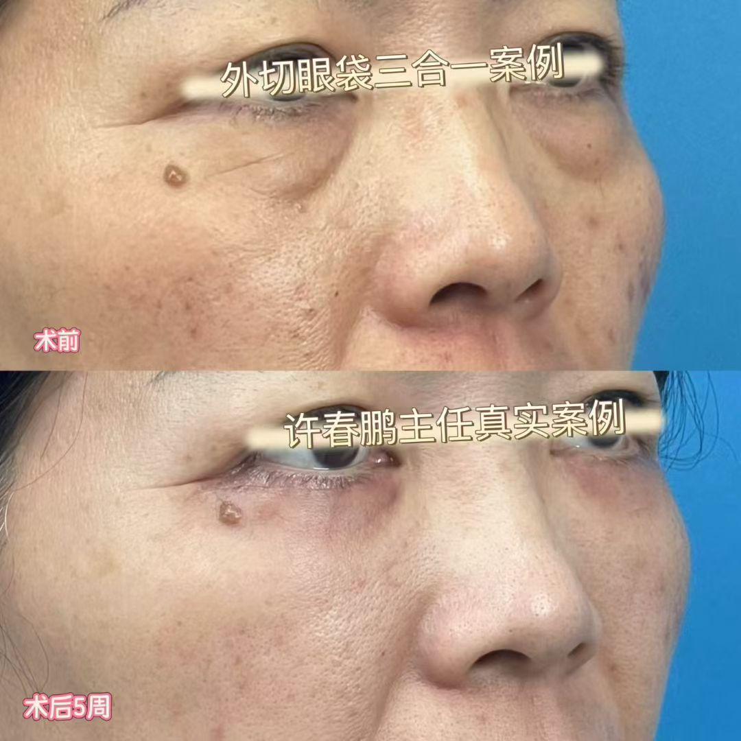 许春鹏医生案例展示 3