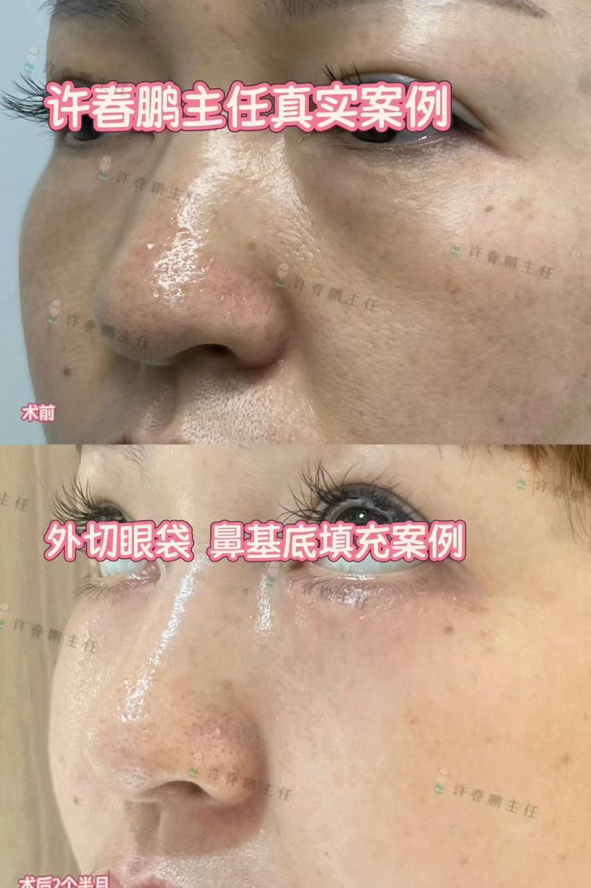 许春鹏医生案例展示 4