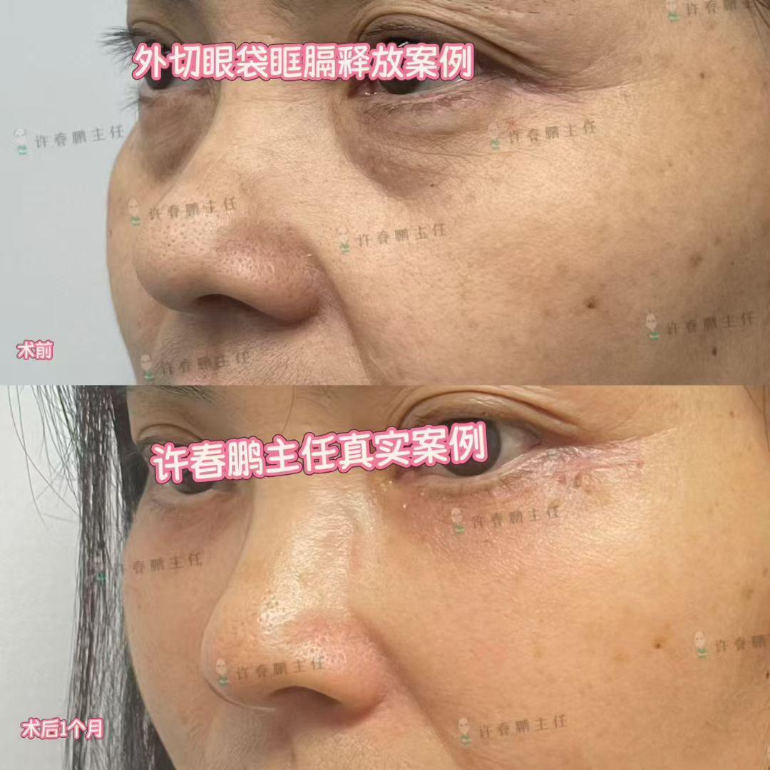 许春鹏医生案例展示 5
