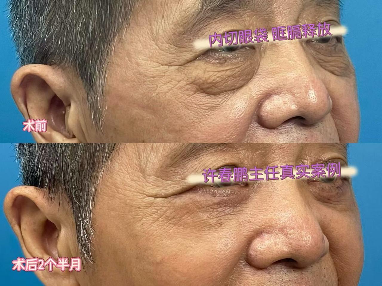 许春鹏医生案例展示 6